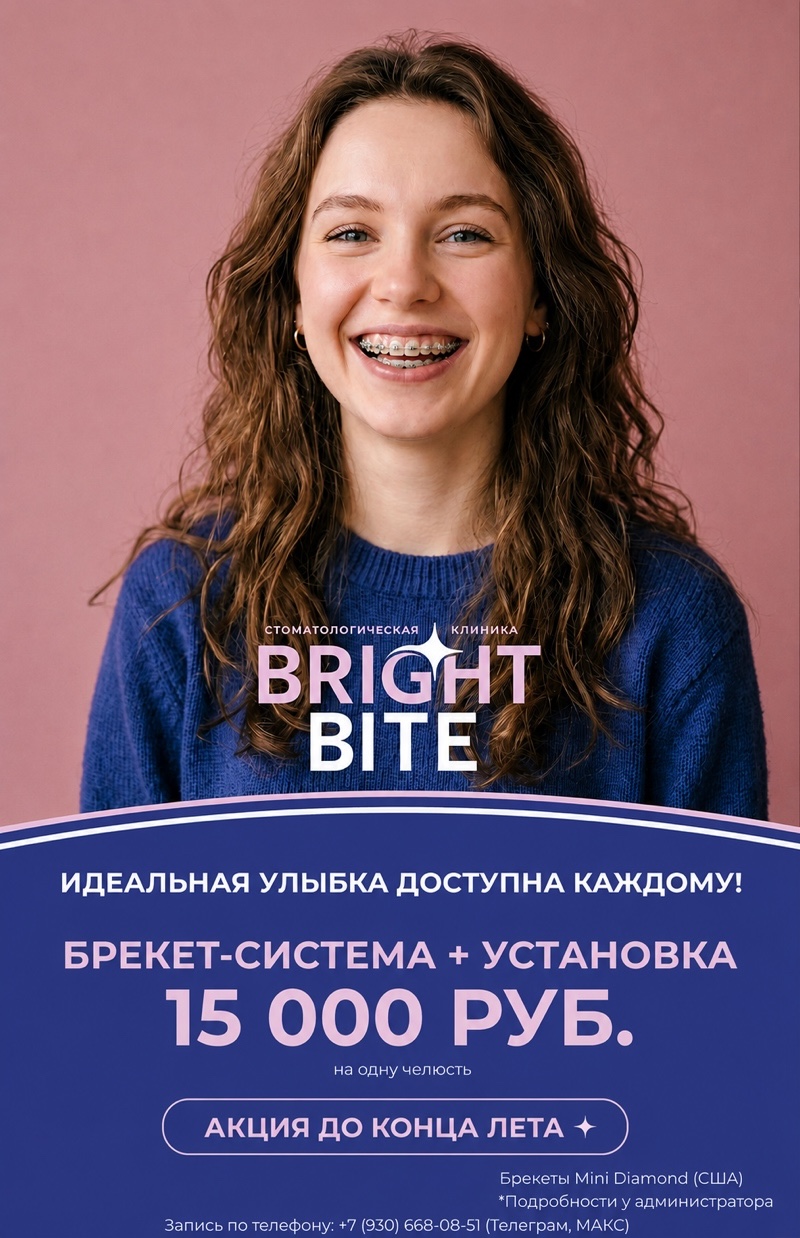 Брекет-система + установка