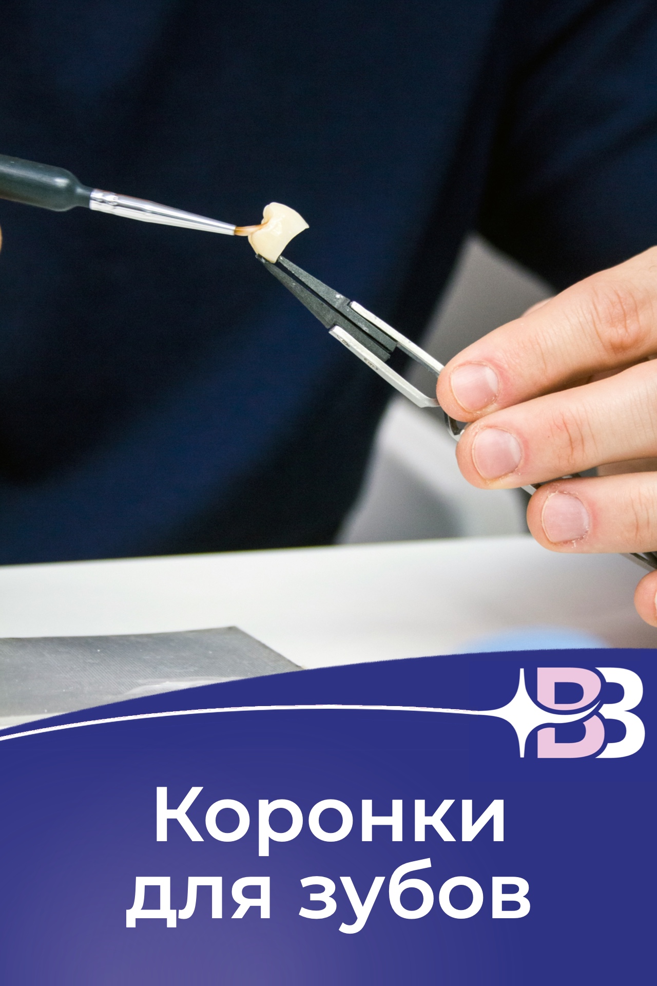 koronki-dlya-zubov.jpg